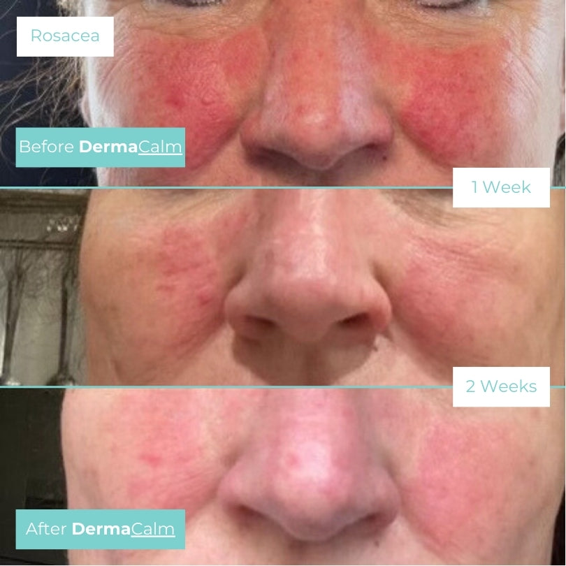 The Rescue Mist Range